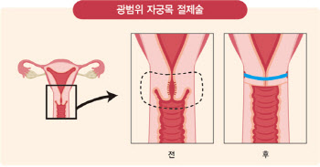 “2030 젊은 자궁경부암, 대부분 예방할 수 있다”