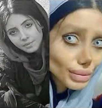 '기괴한 셀피' 올려 징역 10년…이란 인스타그램 스타 구명운동
