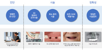 [제약바이오 스페셜] 디오, 디지털임플란트 앞세워 미국에서 '고성장'