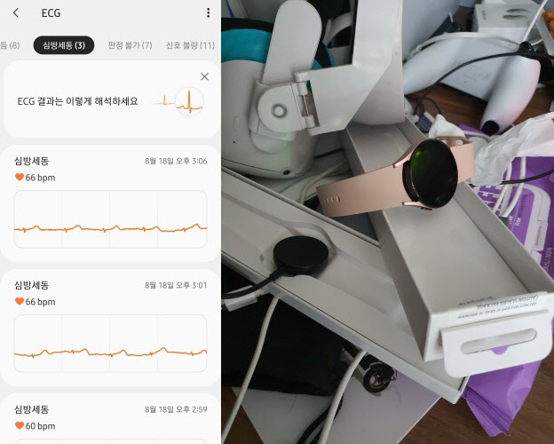 갤워치4, AZ 후 '병원도 못찾은' 심낭염 발견했다 - Vimarsana News