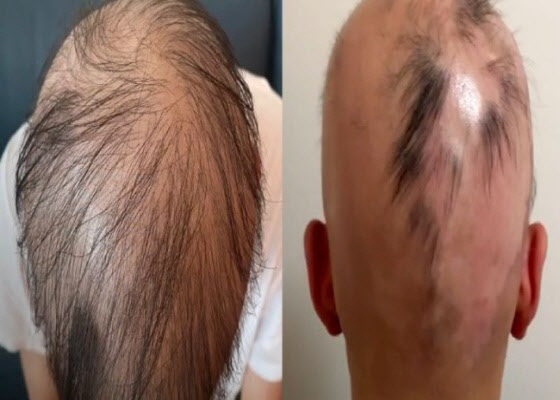 공익 근무하다 ‘탈모’…“과도한 업무” 호소에 답변은?