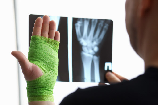 Insurance Fraud: The Rise of False Claims in Fracture Diagnosis Fees