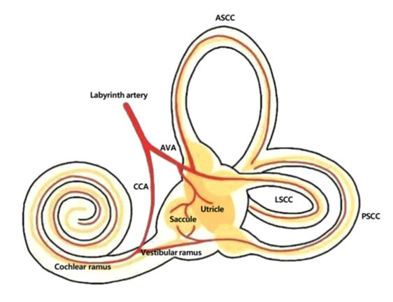 New Treatment Strategy for Sudden Hearing Loss: Research from Sungkyunkwan University School of Medicine