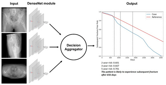 Seoul National University Hospital Develops Deep Learning Model to Predict Hip Fracture Re-fracture Risk with High Accuracy, Outperforms Existing Tools