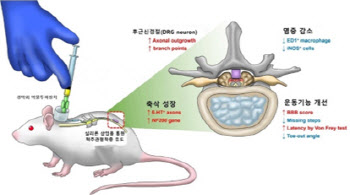 "척추관협착증으로 손상된 신경, 약침으로 치료한다"