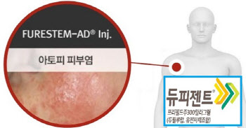 강스템바이오텍, ‘퓨어스템-에이디주’ 3상 결론 임박, ‘듀피젠트’ 뛰어넘을까