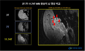 가천대 길병원,  MRI 이용 살아 있는 원숭이 뇌영상 획득 성공