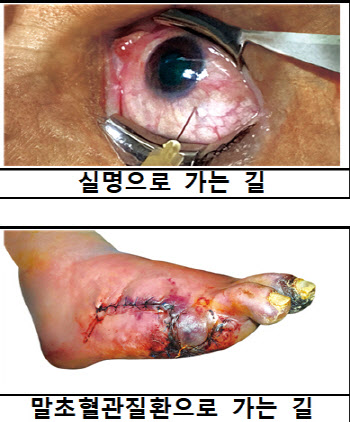 “이래도 피우실 건가요?” 12월 담뱃갑 경고 그림 달라진다