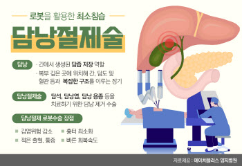 로봇수술 시대, 담낭절제술도 이젠 로봇으로