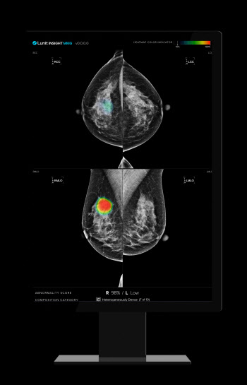 루닛, 유방암 AI 제품도 '빅5' 진입...강북삼성병원과 공급 계약