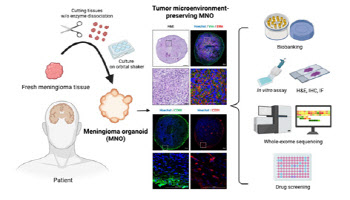 뇌수막종 환자 세포 유래 오가노이드, 국내 첫 개발