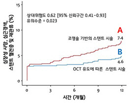 ‘복잡한 관상동맥 질환’, 광간섭단층촬영으로 예후 개선