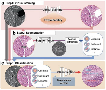 친환경 조직병리 딥러닝 진단법 상용화 첫 걸음