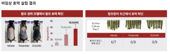 [임상 업데이트] 올릭스, 탈모치료제 추적관찰 완료