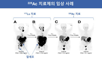 SK바이오팜, ‘악티늄’ 선택한 이유?…기술수출 가능성도↑