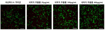 "무 씨앗, 퇴행성 허리디스크 치료에 효과적"