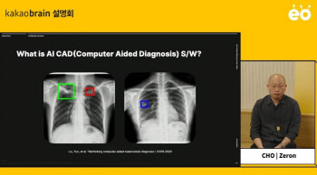공룡 카카오에 완승한 루닛, 흉부AI진단시장 석권 예고