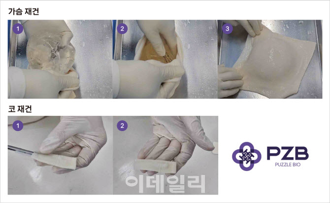 퍼즐비, 세계 최고 수준 '포켓형 수화 무세포동종진피' 제품 출시 - 뉴스 썸네일 이미지