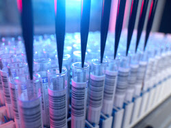 필리핀 HIV 감염 비상 속 美 치료제 승인[클릭, 글로벌 제약·바이오]