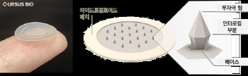 아이큐어 자회사 커서스바이오, 여드름 치료 패치 81% 이상 개선