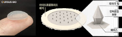 아이큐어 자회사 커서스바이오, 여드름 치료 패치 81% 이상 개선
