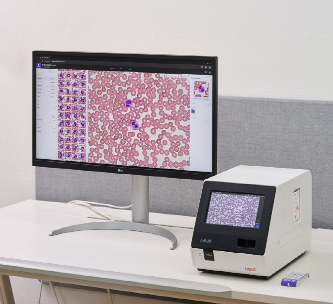 노을, 아산병원과 차세대 AI 기반 혈액분석 솔루션 신제품 성능 결과 공개