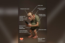 “흡사 골룸” 복부 비만에 거북목…25년 뒤 인류의 모습