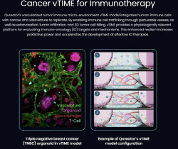 신라젠, 세계 첫 오가노이드 임상 FDA 승인 성과와 의미
