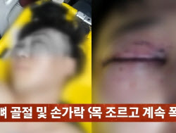 “살려주세요” 애원에도…“알게 뭐냐” 행인 목 조른 20대