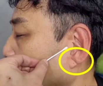 &apos;심정지&apos; 김수용...전조 있었다? 귓불에 이것 뭐길래