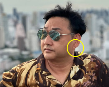 &apos;심정지&apos; 김수용...전조 있었다? 귓불에 이것 뭐길래
