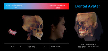 레이, 올해 연간 흑자전환 점쳐지는 이유