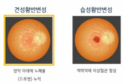 바이오 M&A 급증, 와이투솔루션 美 자회사 관심받는 이유