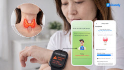 타이로스코프, 美 UCSF헬스와 공동 임상연구 착수