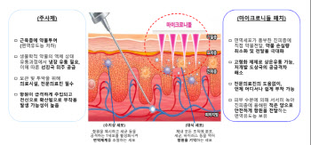 라파스, 마이크로니들 비만패치 SC제형 반감기 넘었다..."기술 수출 기대 UP"