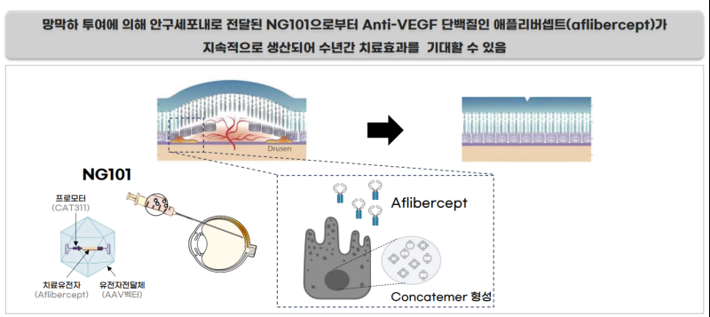 "경쟁사 황반변성치료제 치료 효과 수개월...NG101, 최소 5년 지속"