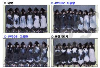 “빠진 머리 다시 자라게 한다?”…JW중외제약, ‘모낭 재생’ 탈모 신약 판 흔든다