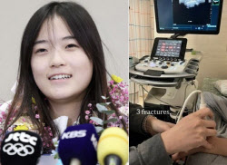 뼈 부러진 채 날았나…'금메달' 최가온, 세 군데 골절 진단