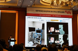 웨이센, 대한위대장내시경학회 참석…“AI내시경 사용 후 선종발견율 향상”