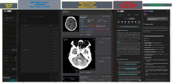 제이엘케이, 의료영상 특화 LLM 플랫폼 론칭...CT·MRI 분석