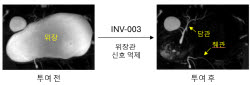인벤테라, 경구용 MRCP 조영제 비임상 패키지 완성…연내 IND 제출
