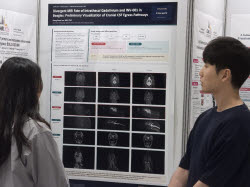 인벤테라 "나노 MRI 조영제, 뇌 림프계 연구로 확장 가능성"