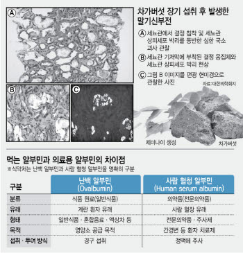 연재이미지
