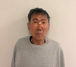 [속보]경찰, 인천 흉기난동범 최충락 신상정보 공개