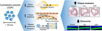 동맥경화증 효과적으로 치료하나...플라크 표적치료 기술 개발