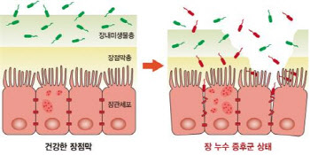 아토피피부염, 음식알레르기 없어도 식이조절 필요해