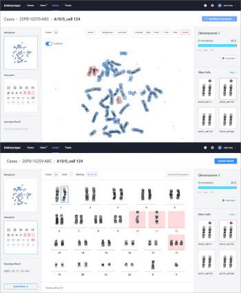 GC녹십자의료재단, AI 기업과 ‘염색체 판독 솔루션’ 공동개발