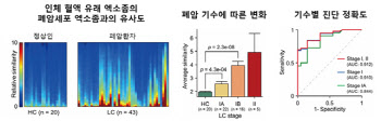 “나노 기술로 폐암 조기진단에 한 발자국 성큼”