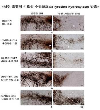 파킨슨병 억제 항산화제, 뇌 직접 투여 시 효과 극대화