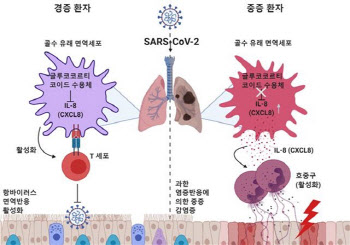 코로나19 중·경증 환자 쉽게 골라낸다···결정 인자 발견